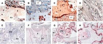 An Up-To-Date Overview of Dental Tissue Regeneration Using Dental Origin Mesenchymal Stem Cells: Challenges and Road Ahead